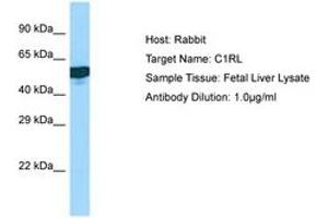 Image no. 1 for anti-Complement Component 1, R Subcomponent-Like (C1RL) (AA 190-239) antibody (ABIN6750160)