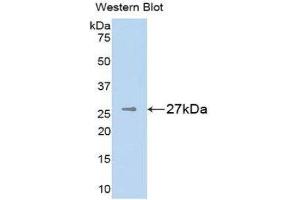 Image no. 1 for anti-Melanoma Associated Chondroitin Sulfate Proteoglycan (MCSP) (AA 1705-1942) antibody (ABIN1859793)