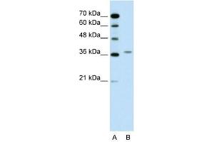 Image no. 1 for anti-Aminolevulinate Dehydratase (ALAD) (N-Term) antibody (ABIN632018)