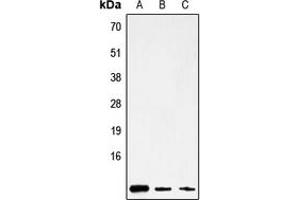 Image no. 1 for anti-Mitochondrially Encoded ATP Synthase 8 (MT-ATP8) (Center) antibody (ABIN2705549)