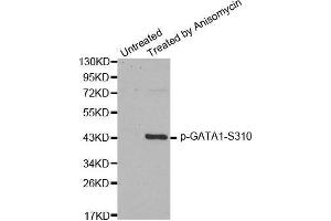Image no. 2 for anti-GATA Binding Protein 1 (Globin Transcription Factor 1) (GATA1) (pSer310) antibody (ABIN3020226)