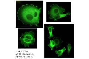 Image no. 1 for anti-Neural Precursor Cell Expressed, Developmentally Down-Regulated 9 (NEDD9) (AA 82-398) antibody (ABIN108572)