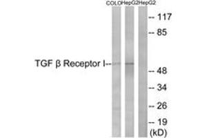 Image no. 1 for anti-Transforming Growth Factor, beta Receptor 1 (TGFBR1) (AA 131-180) antibody (ABIN1532728)