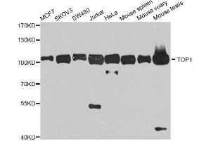 Image no. 3 for anti-Topoisomerase (DNA) I (TOP1) antibody (ABIN6149391)