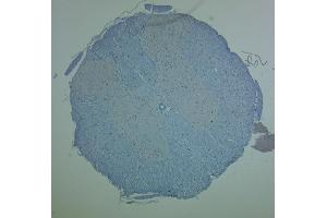 Image no. 1 for anti-Oligodendrocyte Lineage Transcription Factor 2 (OLIG2) (AA 2-50) antibody (ABIN1842155)