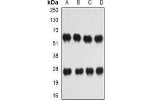 Image no. 2 for anti-Interleukin 27 (IL27) antibody (ABIN3197698)
