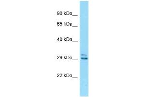 anti-EP300 Interacting Inhibitor of Differentiation 2 (EID2) (C-Term) antibody