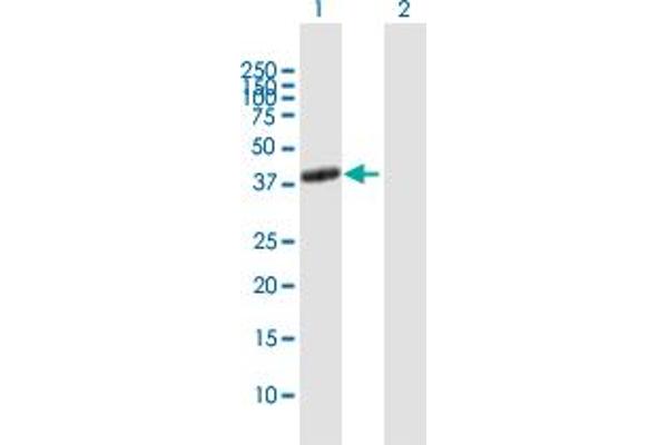 Adenosine A2a Receptor anticorps  (AA 1-412)
