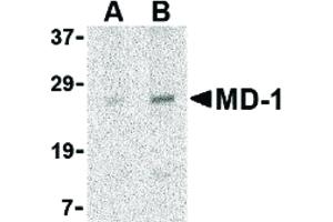 Western Blot of MD-1 Antibody - Western Blot of MD-1 antibody in Daudi cell lysate.