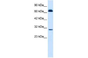 Image no. 2 for anti-Sirtuin 3 (SIRT3) (C-Term) antibody (ABIN2779610)
