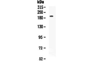 Image no. 2 for anti-VEGF Receptor 2 (VEGFR2) (AA 20-244) antibody (ABIN5693262)