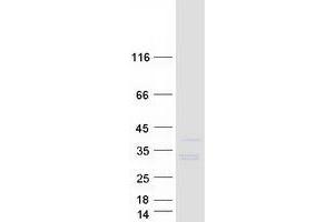 Image no. 1 for serine/arginine-Rich Splicing Factor 12 (SRSF12) protein (Myc-DYKDDDDK Tag) (ABIN2731912)