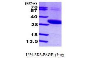 Image no. 1 for Uridine-Cytidine Kinase 2 (UCK2) (AA 1-261) protein (His tag) (ABIN667281)
