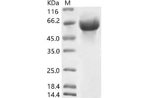 Image no. 1 for Coronavirus OC43 Hemagglutinin Esterase (HCoV-OC43 HE) protein (His tag) (ABIN7198833)