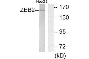 Image no. 2 for anti-Zinc Finger E-Box Binding Homeobox 2 (ZEB2) (N-Term) antibody (ABIN1848992)