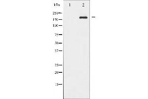 Image no. 10 for anti-Insulin Receptor Substrate 1 (IRS1) (pSer636) antibody (ABIN6255436)