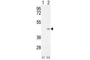 Image no. 3 for anti-Alcohol Dehydrogenase 4 (Class II), pi Polypeptide (ADH4) (AA 326-356), (C-Term) antibody (ABIN950338)