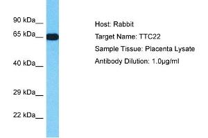 Image no. 1 for anti-Tetratricopeptide Repeat Domain 22 (TTC22) (N-Term) antibody (ABIN2791964)