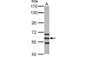 Image no. 3 for anti-AarF Domain Containing Kinase 1 (ADCK1) (Center) antibody (ABIN2856808)