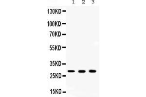 Image no. 1 for anti-Carbonic Anhydrase II (CA2) (AA 2-260) antibody (ABIN4886493)