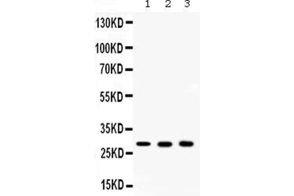 anti-Carbonic Anhydrase II (CA2) (AA 2-260) antibody