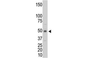 Image no. 3 for anti-Creatine Kinase, Muscle (CKM) antibody (ABIN3002974)