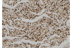 Image no. 1 for anti-Granzyme H (Cathepsin G-Like 2, Protein H-CCPX) (GZMH) antibody (ABIN6262073)