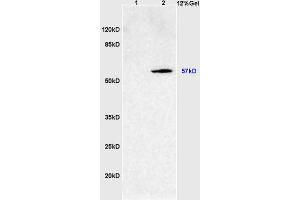 Image no. 3 for anti-Sterol O-Acyltransferase 2 (SOAT2) (AA 331-430) antibody (ABIN708476)