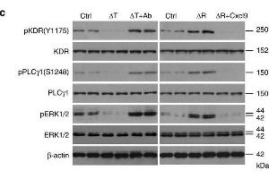 Image no. 3 for anti-VEGF Receptor 2 (VEGFR2) (pTyr1175) antibody (ABIN3020298)