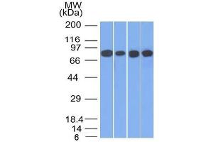 Image no. 1 for anti-Junction Plakoglobin (JUP) antibody (ABIN6939838)