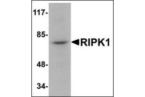 Image no. 2 for anti-Receptor (TNFRSF)-Interacting serine-threonine Kinase 1 (RIPK1) (N-Term) antibody (ABIN500614)
