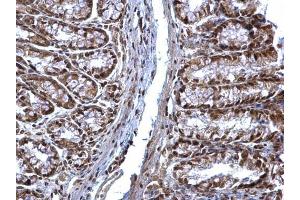 IHC-P Image SOCS1 antibody detects SOCS1 protein at nucleus on mouse colon by immunohistochemical analysis.