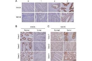Immunohistochemical (IHC) results of monoamine oxidase A (MAOA) and MAOB expressions in a Taiwanese colorectal cancer cohort.