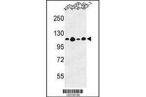 Western Blotting (WB) image for anti-Collagen, Type XVII, alpha 1 (COL17A1) antibody (ABIN2158313)