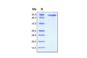 Human CD4, Fc Tag on SDS-PAGE under reducing (R) condition.