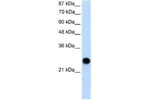 anti-Voltage-Dependent Anion Channel 2 (VDAC2) (N-Term) antibody