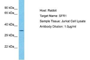 Image no. 1 for anti-SWI5-Dependent Recombination Repair 1 (SFR1) (N-Term) antibody (ABIN2791661)