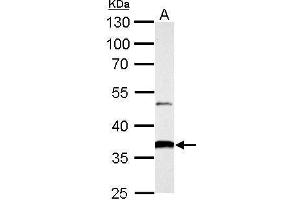 Image no. 6 for anti-Aldo-Keto Reductase Family 1, Member B10 (Aldose Reductase) (AKR1B10) (full length) antibody (ABIN2856687)