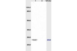 Image no. 2 for anti-Synaptosomal-Associated Protein, 25kDa (SNAP25) (AA 166-206) antibody (ABIN738111)