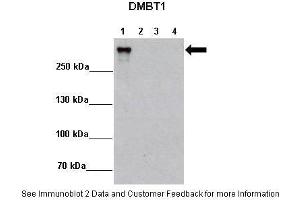 Image no. 3 for anti-Deleted in Malignant Brain Tumors 1 (DMBT1) (N-Term) antibody (ABIN2775367)