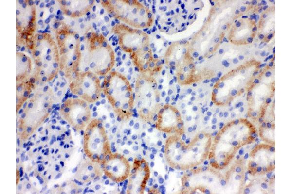 anti-Solute Carrier Family 22 (Organic Cation Transporter), Member 2 (SLC22A2) (AA 524-555), (Middle Region) antibody