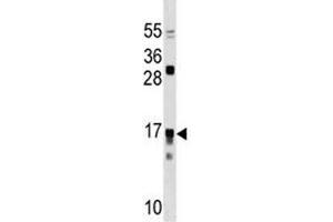 Image no. 2 for anti-Interleukin 17 Receptor C (IL17RC) (AA 103-131) antibody (ABIN3028754)