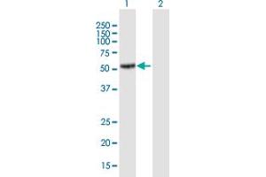 Image no. 1 for anti-Zinc Finger Protein 597 (ZNF597) (AA 1-424) antibody (ABIN1327734)
