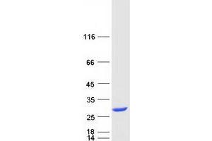 Image no. 1 for Prefoldin Subunit 3 (PFDN3) protein (Myc-DYKDDDDK Tag) (ABIN2712343)