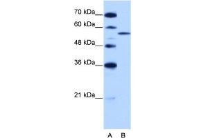 Image no. 3 for anti-Zinc Finger (CCCH Type), RNA-Binding Motif and serine/arginine Rich 2 (ZRSR2) (C-Term) antibody (ABIN2778926)