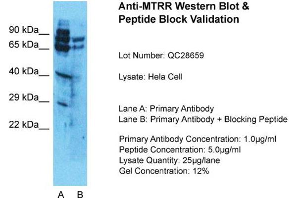 MTRR antibody  (N-Term)