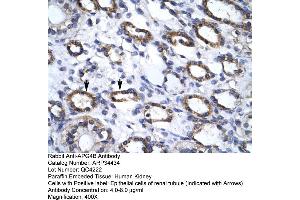 Image no. 2 for anti-Autophagy related 4B Cysteine Peptidase (ATG4B) (C-Term) antibody (ABIN2775793)