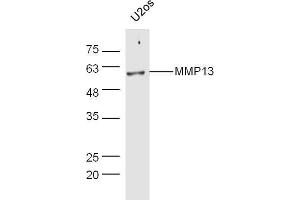Image no. 2 for anti-Matrix Metallopeptidase 13 (Collagenase 3) (MMP13) (AA 201-300) antibody (ABIN670341)