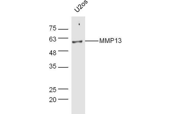 MMP13 anticorps  (AA 201-300)