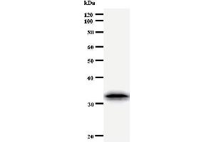 Image no. 3 for anti-Twist Homolog 1 (Drosophila) (TWIST1) antibody (ABIN933111)